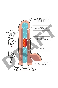 Вибратор REAL NEXT № 31 с выносным блоком, L 200 мм D 50 мм арт. 573113