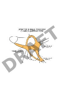 Эректор с фиксацией